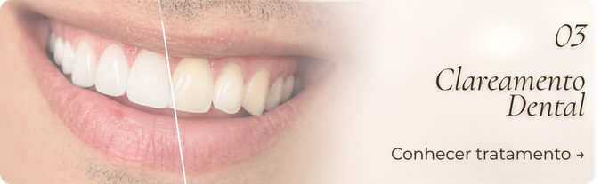 Clareamento Dental