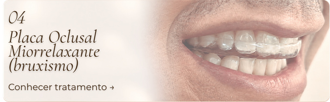 Placa Oclusal Miorrelaxante (bruxismo)